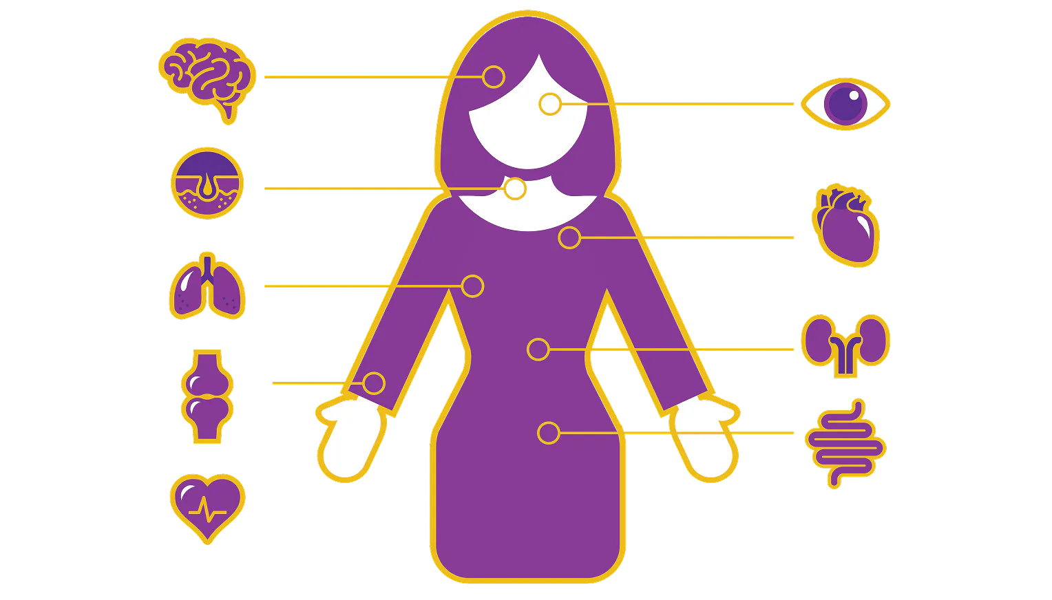 Diagram showing different areas of the body that may be affected by lupus