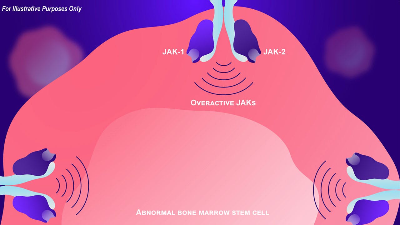 Abnormal bone marrow stem cell