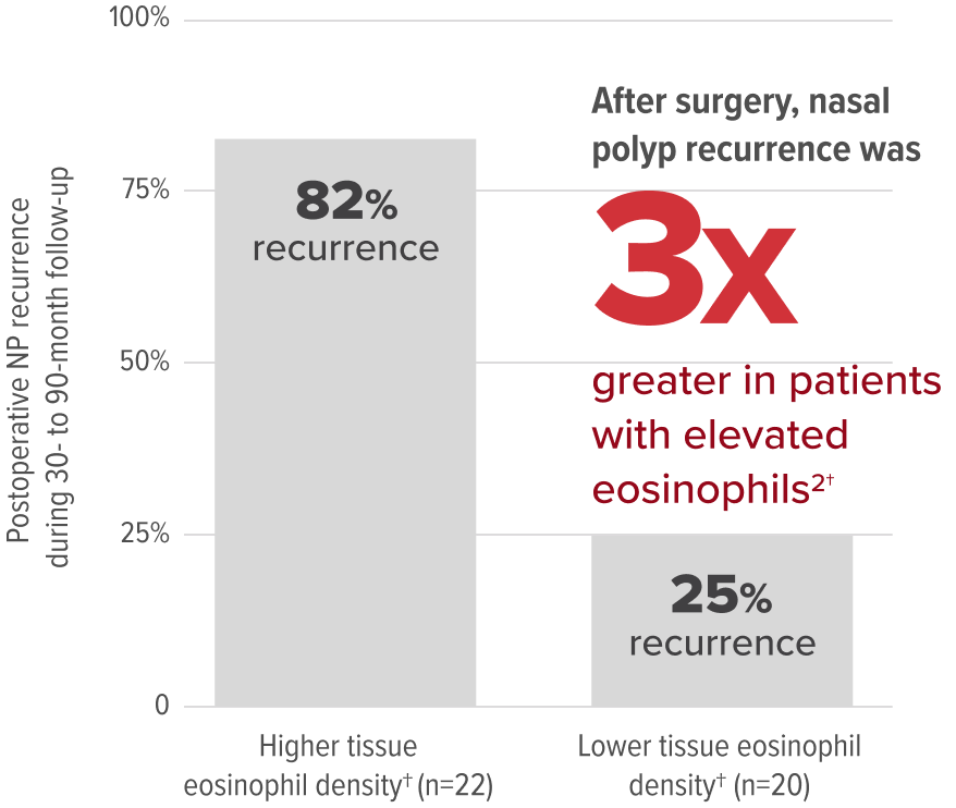 After surgery, nasal polyp recurrence was three times greater in patients with elevated eosinophils After surgery, nasal polyp recurrence was three times greater in patients with elevated eosinophils