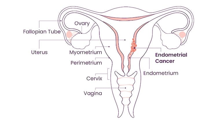 Anatomy of the female reproductive system