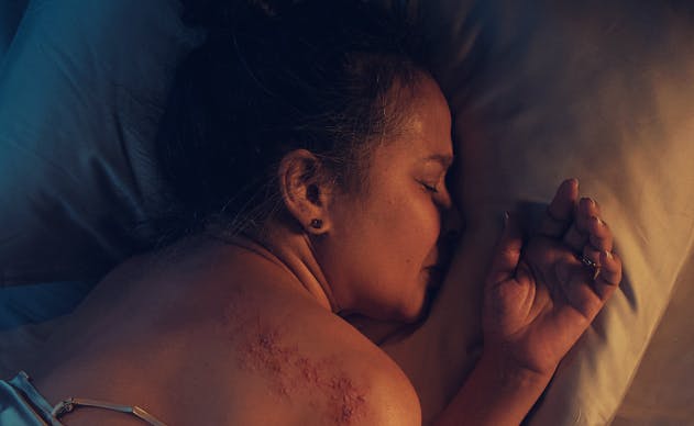 Shingles disrupting a woman's sleep