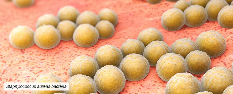 Cutaneous complications, due to Staphylococcus aureus bacteria