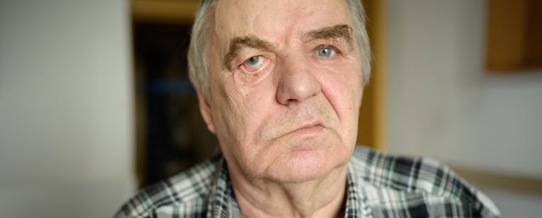 Neurologic complications, such as facial palsy