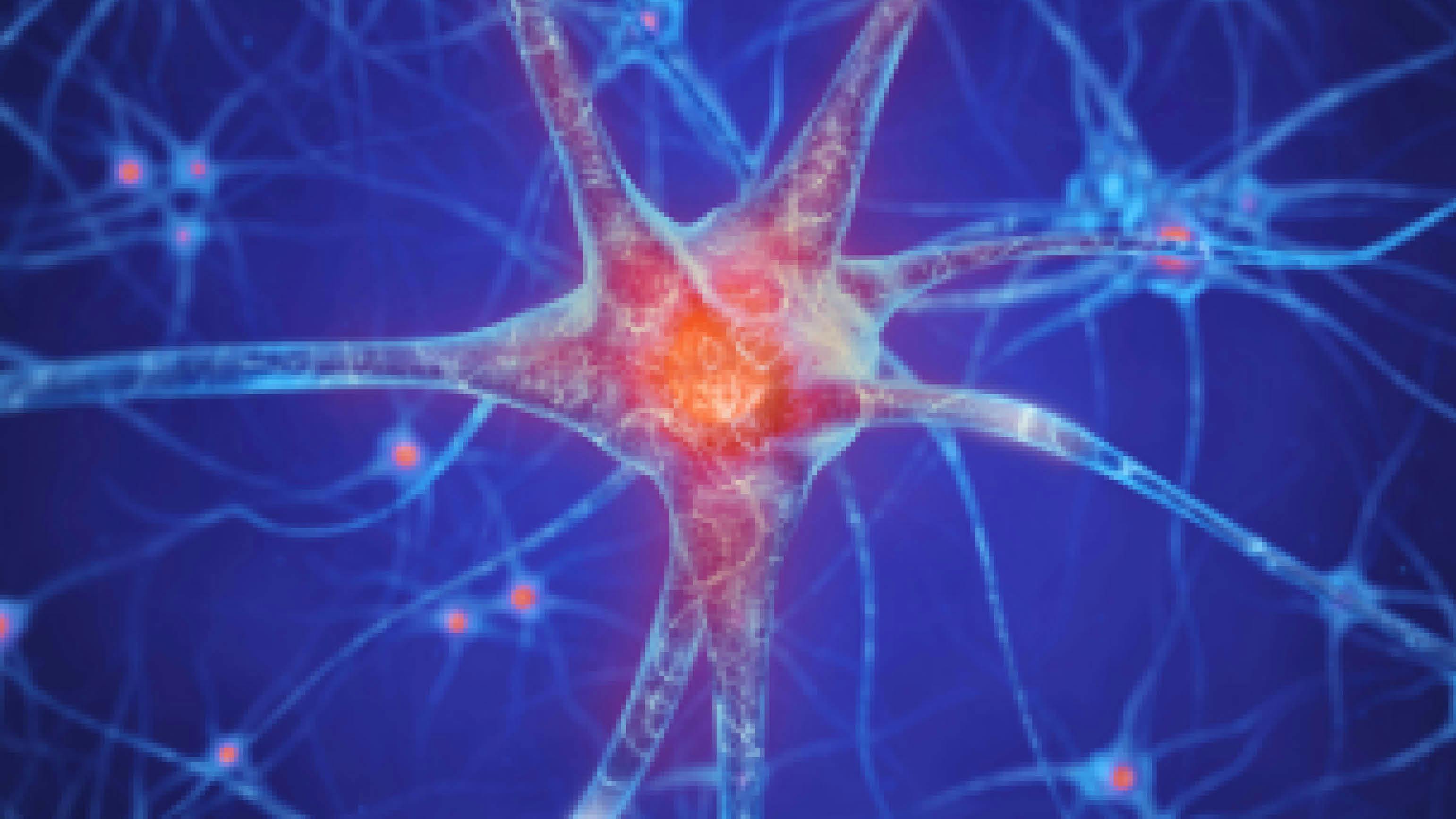 Illustration of a neuron with a red pain center representing postherpetic neuralgia (PHN) caused by shingles