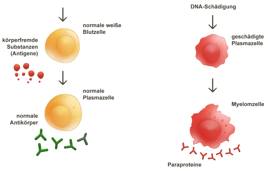 Über das Multiple Myelom