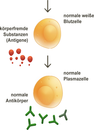 Über das Multiple Myelom
