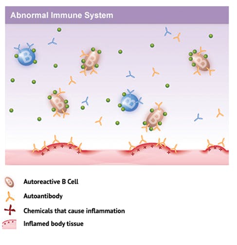Diagram: abnormal Immune System