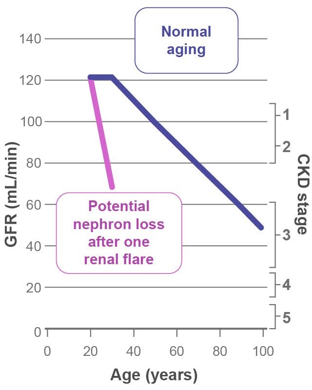 Potential impact of lupus nephritis on kidney lifespan chart