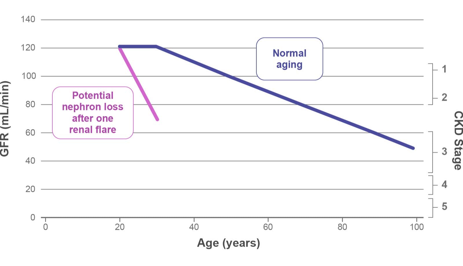 Potential impact of lupus nephritis on kidney lifespan chart