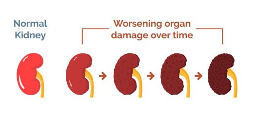 All kidney Art Element 