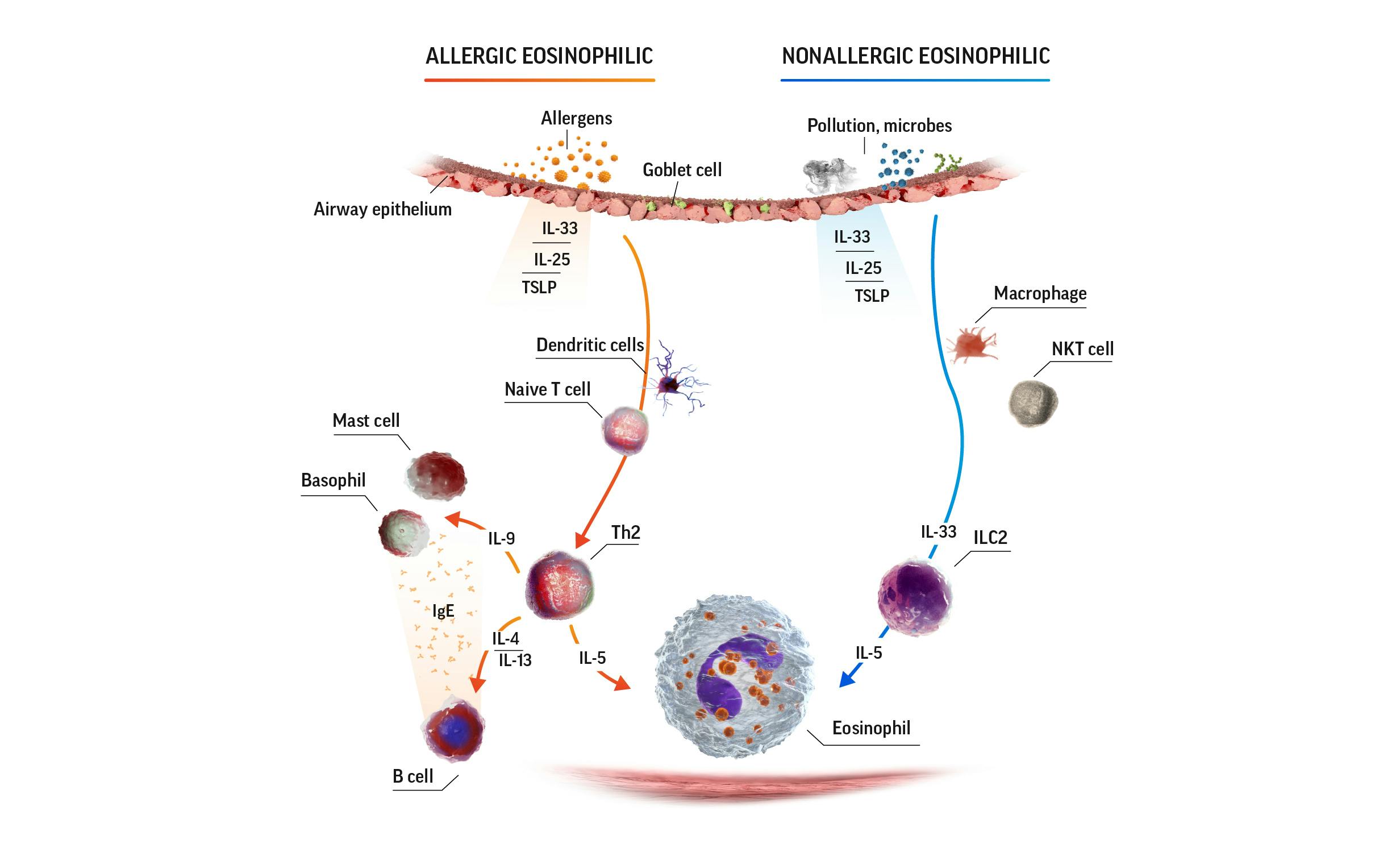 Eosinophilic airway in SEA diagram