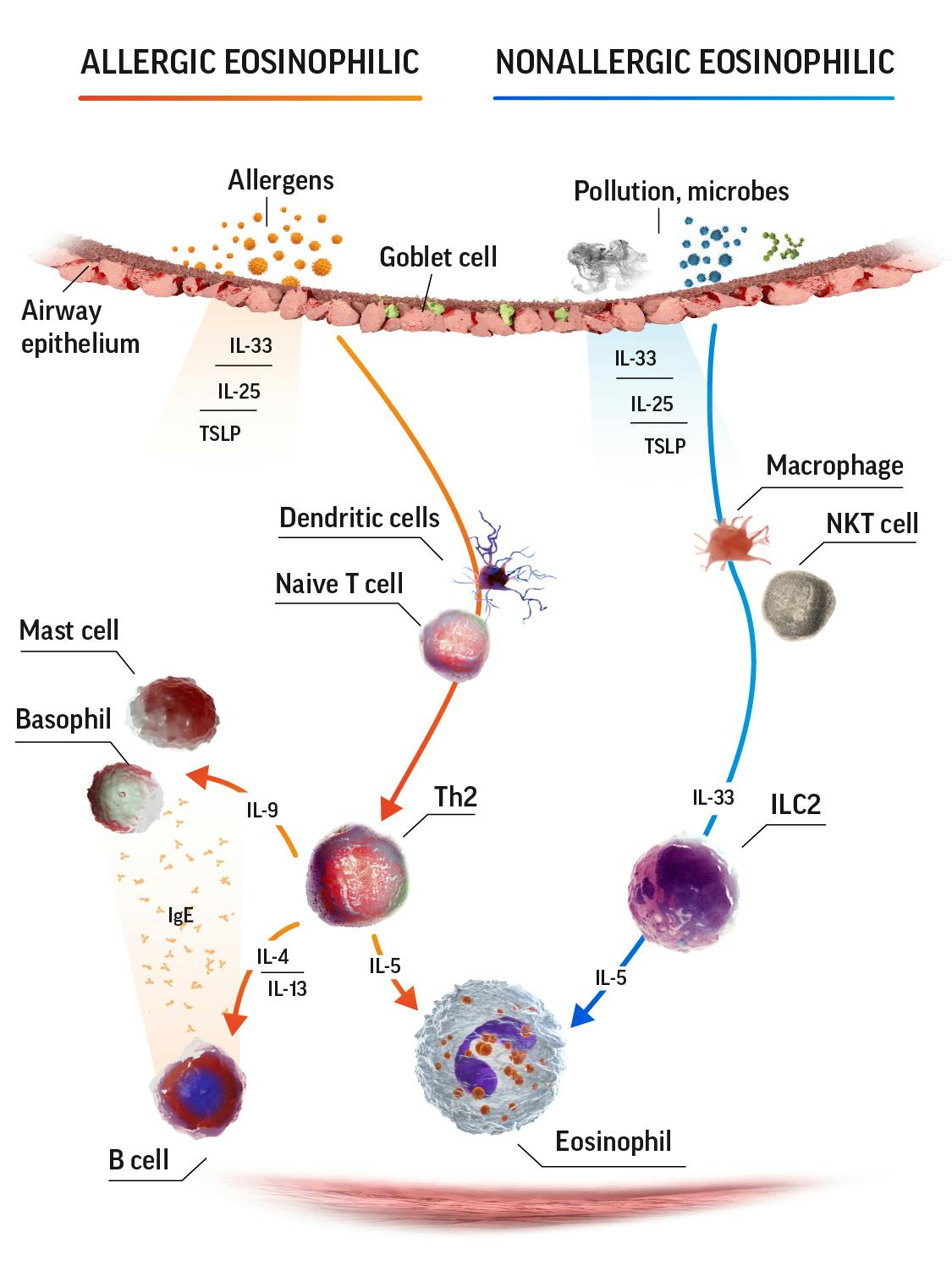 Eosinophilic airway in SEA diagram