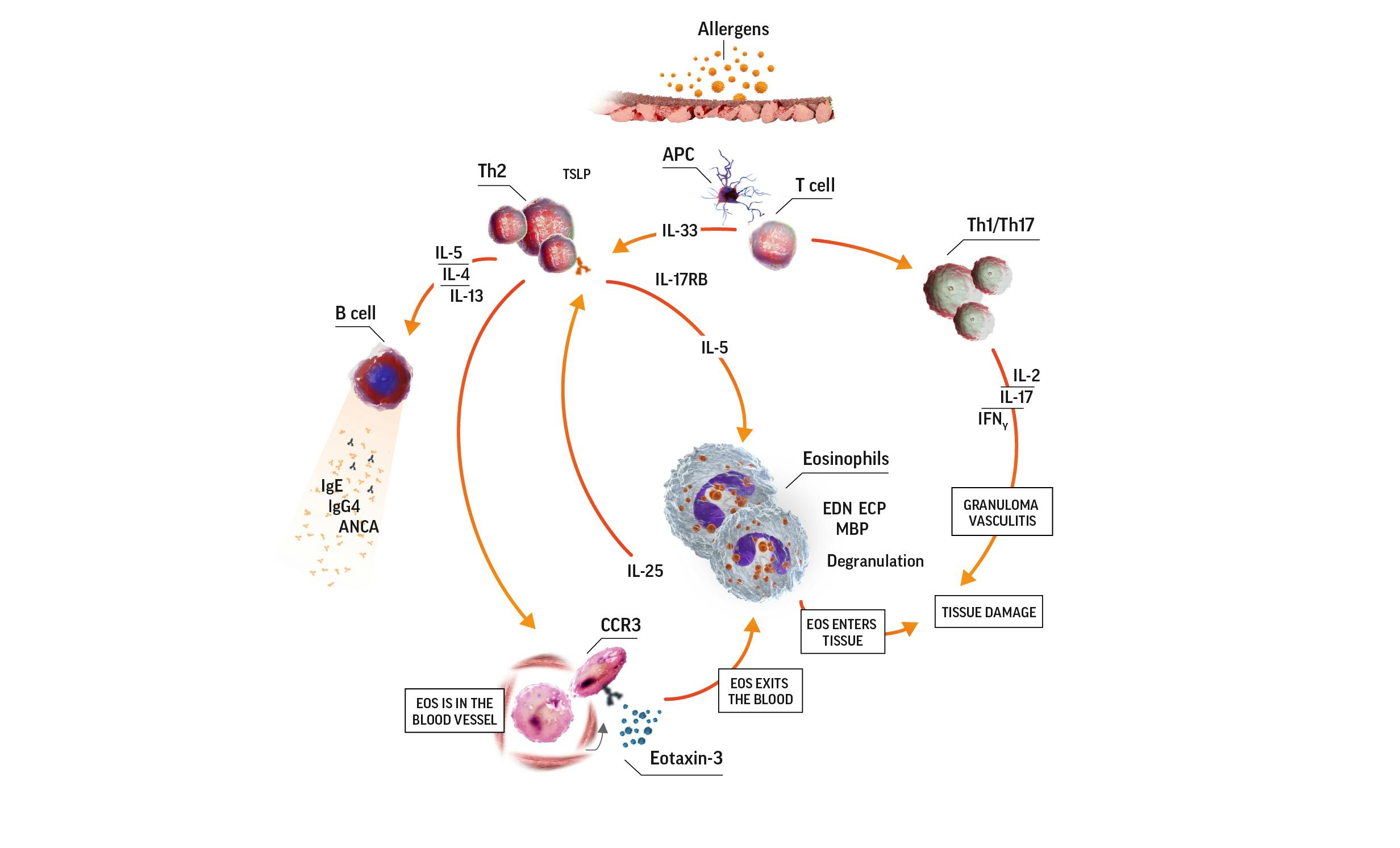 Diagram of eosinophilia in EGPA pathogenesis