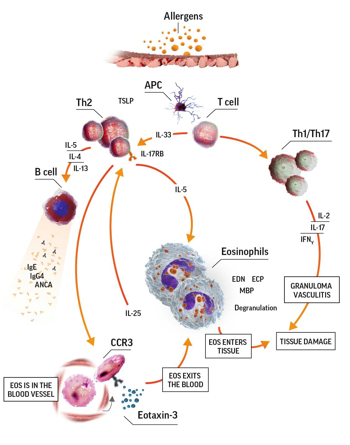 Eosinophilia in EGPA 