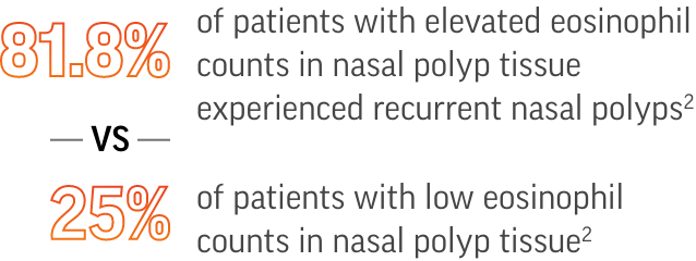 81.8% of patients with elevated eosinophil counts in nasal polyp tissue experienced recurrent nasal polyps² - VS - 25% of patients with low eosinophil counts in nasal polyp tissue²