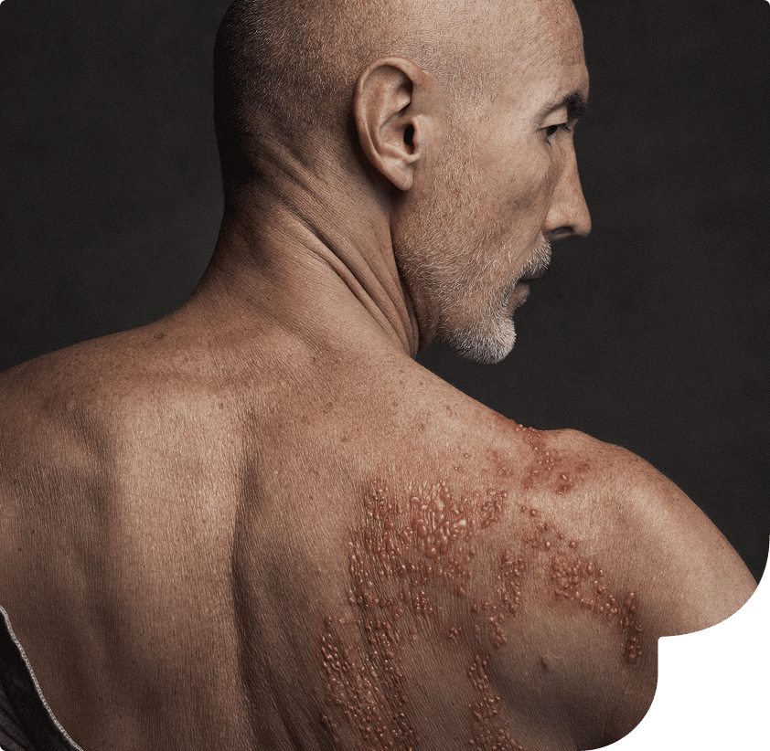 Homem exibindo as costas