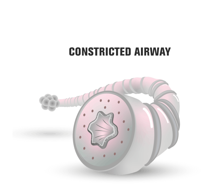 Constricted airway representation
