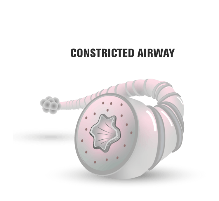 Constricted airway representation Constricted airway representation