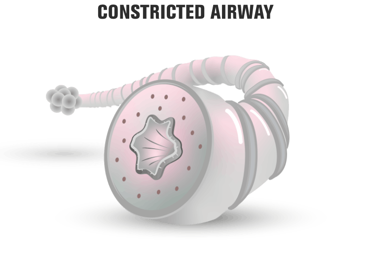 Constricted airway representation Constricted airway representation