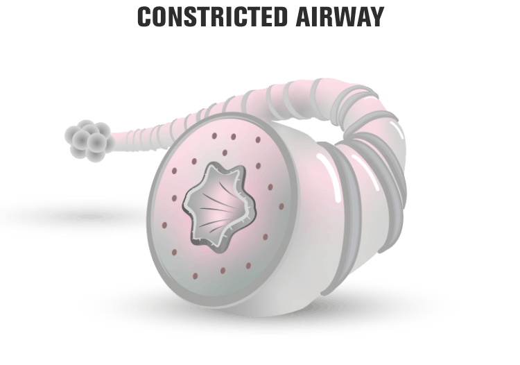 Constricted airway representation