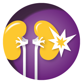 Icon: Renal flare