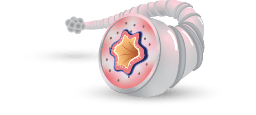 ICS (fluticasone furoate) reduces inflammation