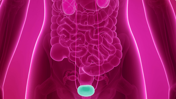Uncomplicated UTI image