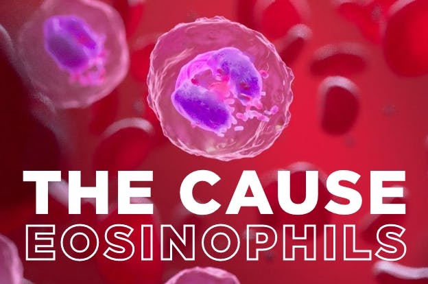 The cause: eosinophils