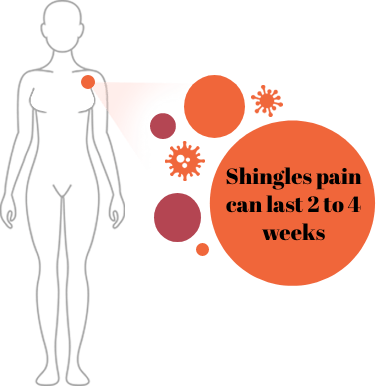 Diagram of where shingles symptoms may appear