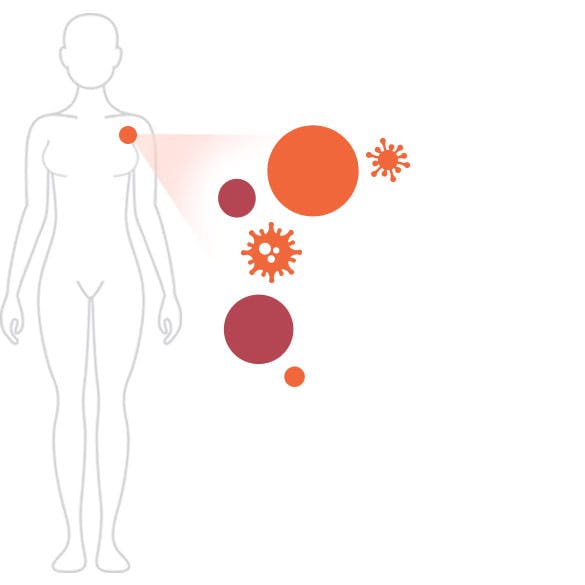 shingles pain image shingles pain image