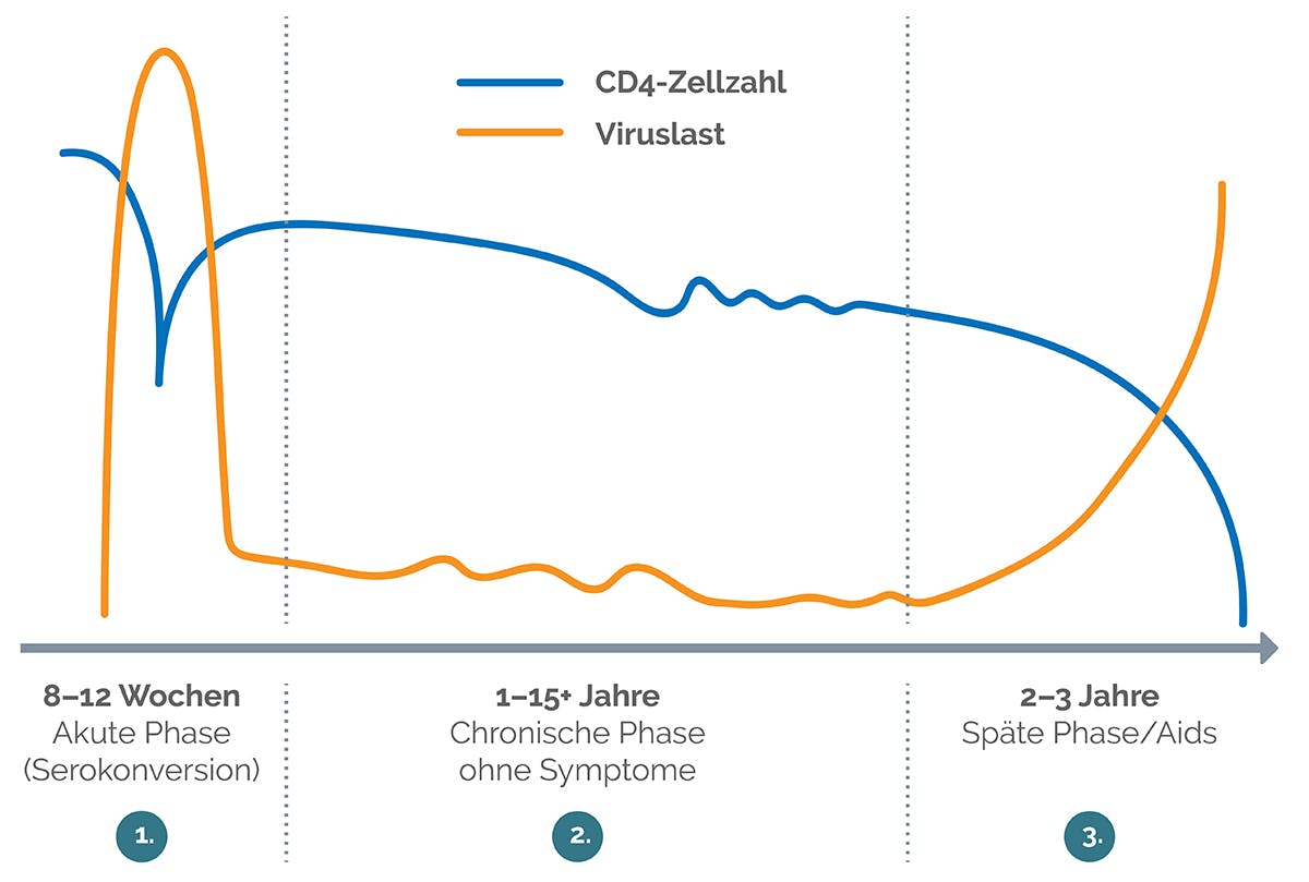 Verlauf einer unbehandelten HIV Infektion mit Viruslast und CD4-Zellen